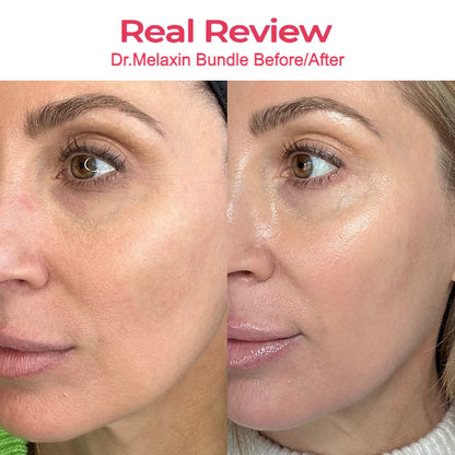 Dr. Melaxin | Skin Rebuild System